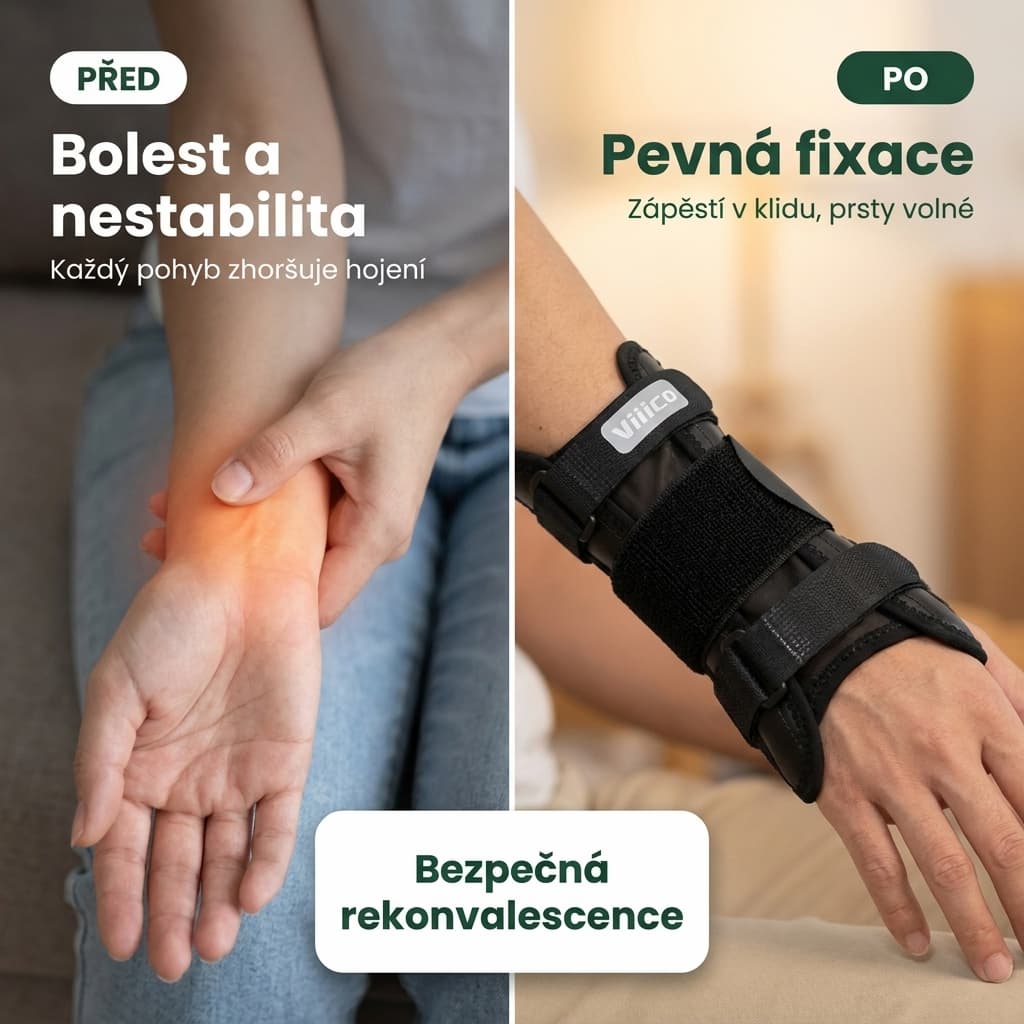 Tuhá ortéza na zápěstí před a po – bolest vs pevná fixace